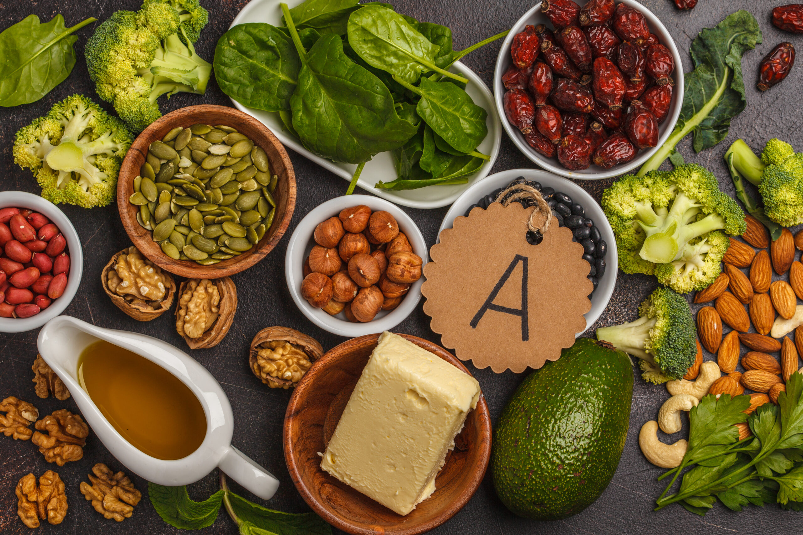 Plant based diet